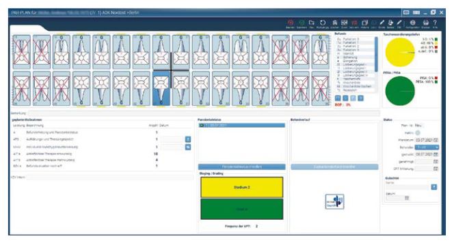 Behandlung vom 03.07.2021 in Z1.PRO